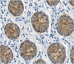 MilliporeSigma anti-CEP Clone: 7E12H12, 100&mu;L, Unlabeled:Antibodies,